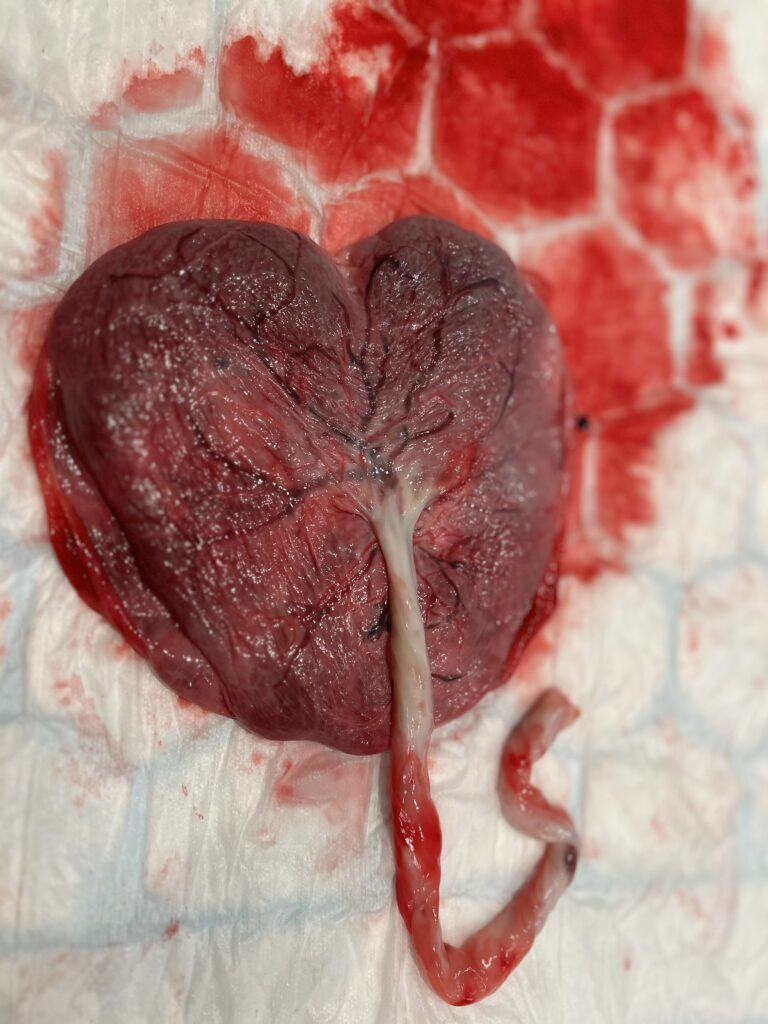 placenta remedies in Sussex by Virginia rowan private midwife