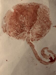 placenta remedy brighton