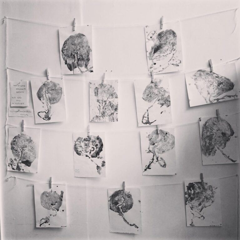 placenta remedies brighton and eastbourne